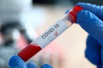 Bilanț COVID-19 | 7.589 de cazuri noi de COVID în ultimele 24 de ore, 462 de decese