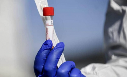 Creștere semnificativă a infectărilor cu SARS- COV-2: 14.775 și a numărului deceselor – 207- în ultimele 24 de ore