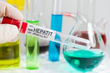 Peste 200 de cazuri de hepatită de cauză necunoscută, înregistrate în Marea Britanie. Alți 20 de copii, confirmați vineri