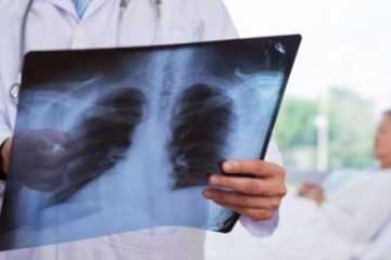 Diagnosticată şi tratată la timp, tuberculoza poate fi vindecată