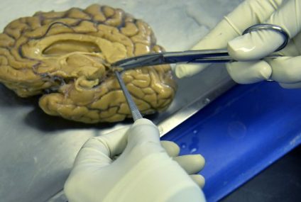Omul care a sfidat genetica timp de zeci de ani poate avea un indiciu pentru prevenirea bolii Alzheimer, spun oamenii de știință – CNN