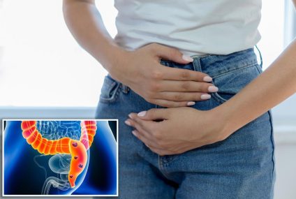 Creșterea cancerului colorectal la tineri ar putea fi cauzată de ciuperci – New York Post