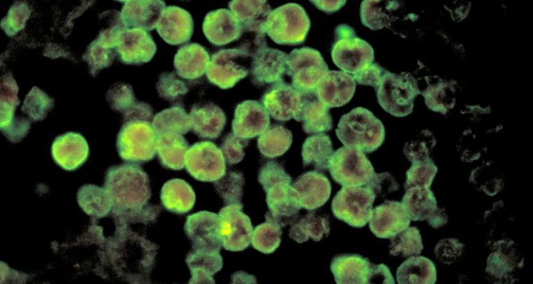 an-arkansas-toddler-dies-of-rare-brain-eating-amoeba-infection-likely-contracted-at-splash-pad-–-cnn