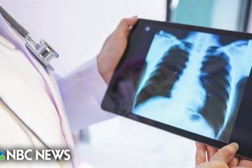 New lung cancer screening guidelines make millions more eligible for testing – NBC News
