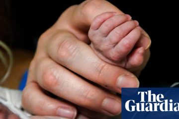 Rate of US babies born prematurely has grown 12%, analysis says – The Guardian