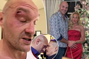 Tyson Fury’s wife left ‘shaking’ by gruesome cut that postponed Oleksandr Usyk bout – New York Post