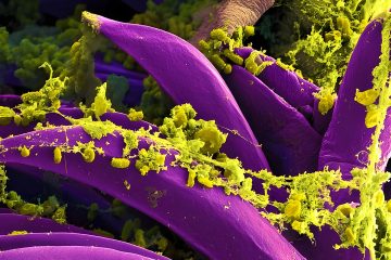 Oregon health officials confirm first human bubonic plague case since 2015 – Fox News