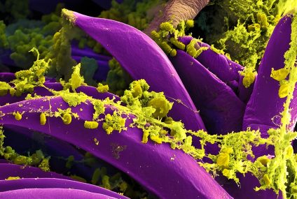 Oregon health officials confirm first human bubonic plague case since 2015 – Fox News