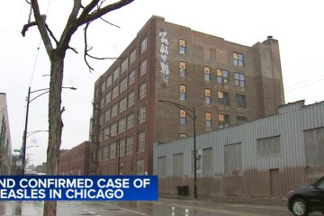 Measles in Chicago: Child diagnosed at Pilsen migrant shelter in second city case in 24 hours, CDPH says – WLS-TV