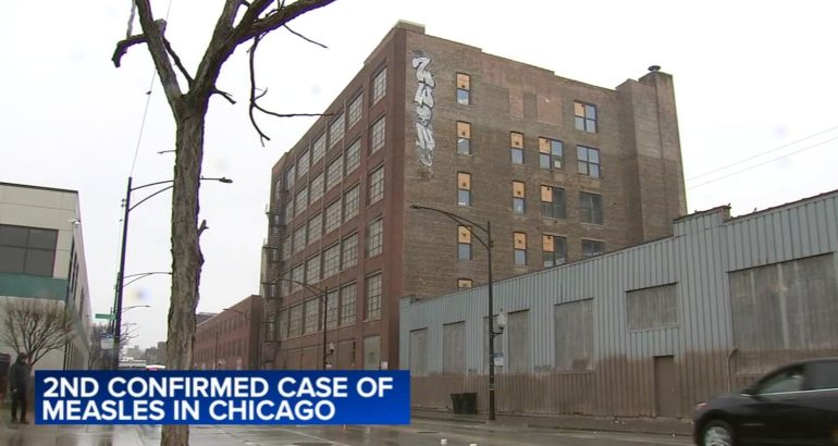 measles-in-chicago:-child-diagnosed-at-pilsen-migrant-shelter-in-second-city-case-in-24-hours,-cdph-says-–-wls-tv