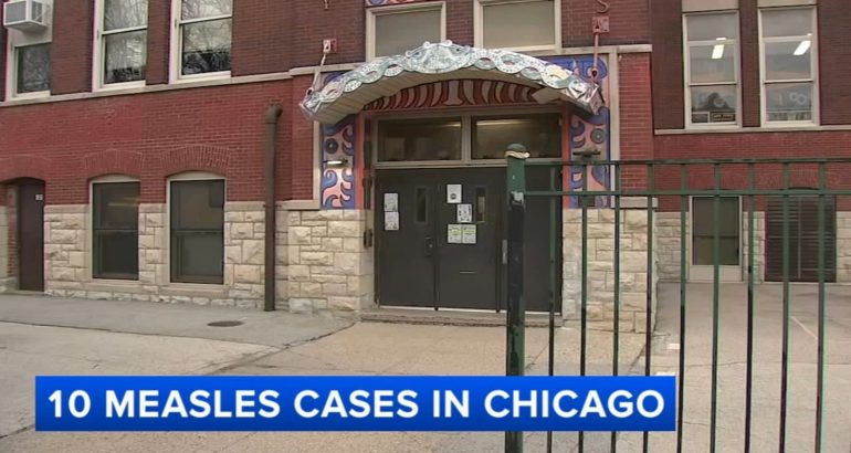 measles-outbreak-in-chicago:10-cases-reported,-with-spread-to-cps-schools-cooper-dual-language-academy,-armour-elementary-–-wls-tv