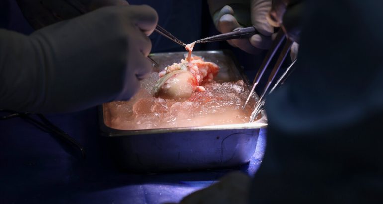 patient-with-transplanted-pig-kidney-leaves-hospital-for-home-–-the-new-york-times