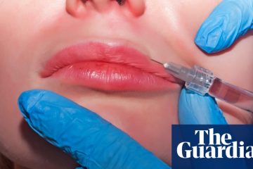 Three women diagnosed with HIV after getting ‘vampire facials’ in New Mexico – The Guardian
