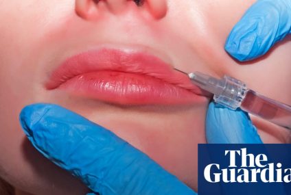 Three women diagnosed with HIV after getting ‘vampire facials’ in New Mexico – The Guardian