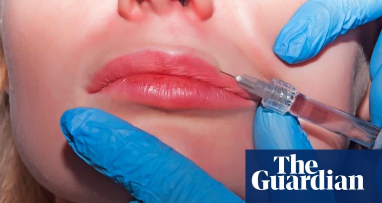 three-women-diagnosed-with-hiv-after-getting-‘vampire-facials’-in-new-mexico-–-the-guardian