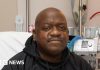 Man who received first pig kidney transplant dies aged 62 – BBC.com